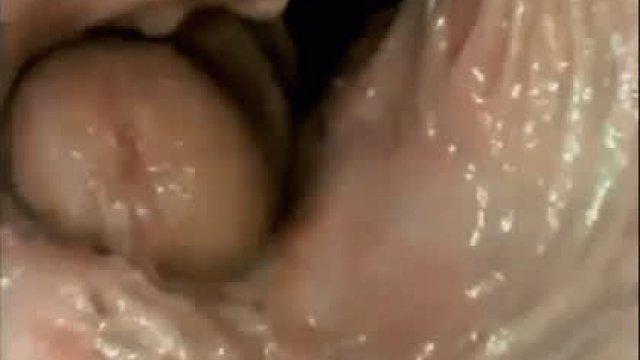 Pussy Vision